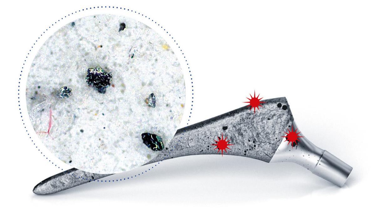 Technical Paper Critical Particles on Medical Products