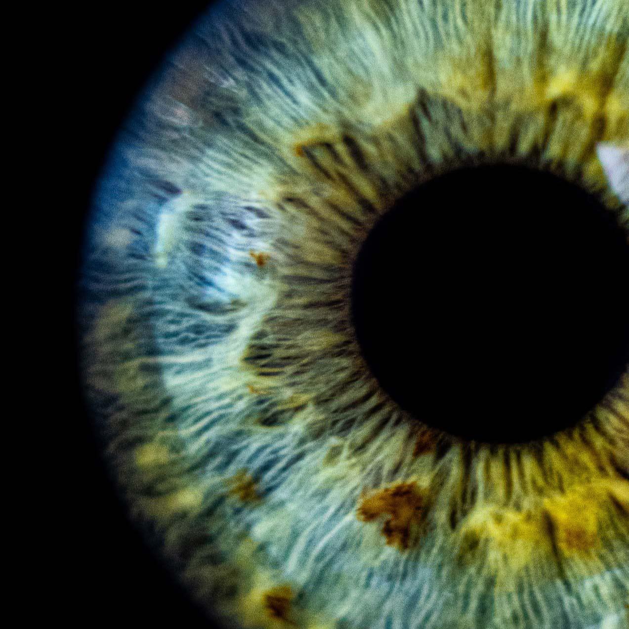 Een close-up van een oog.