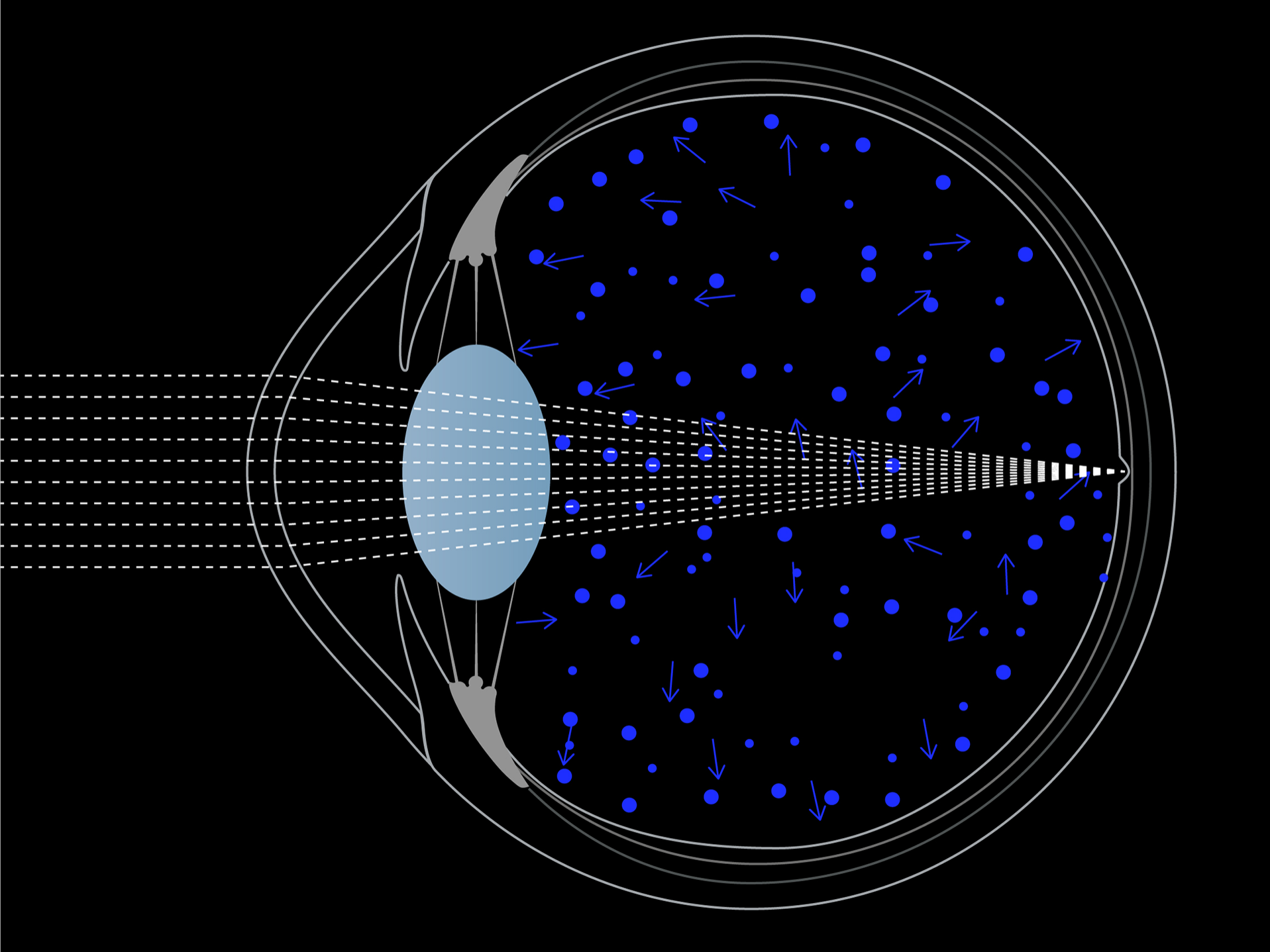 Illustratie van licht dat het oog binnenkomt, waarop te zien is hoe blauw licht meer door het oog verstrooid wordt dan wit licht. 